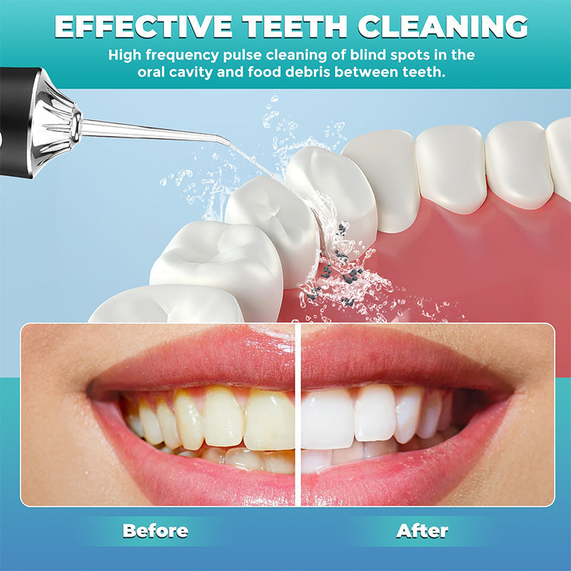 Tyiiplus™ Rechargeable Electric Plaque Remover